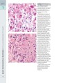Фото Wheater's Basic Pathology: A Text, Atlas, and Review of Histopathology. International Edition, 5th Edition 11