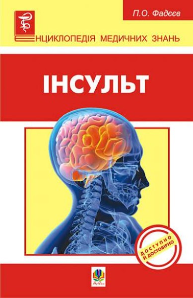Фото Інсульт